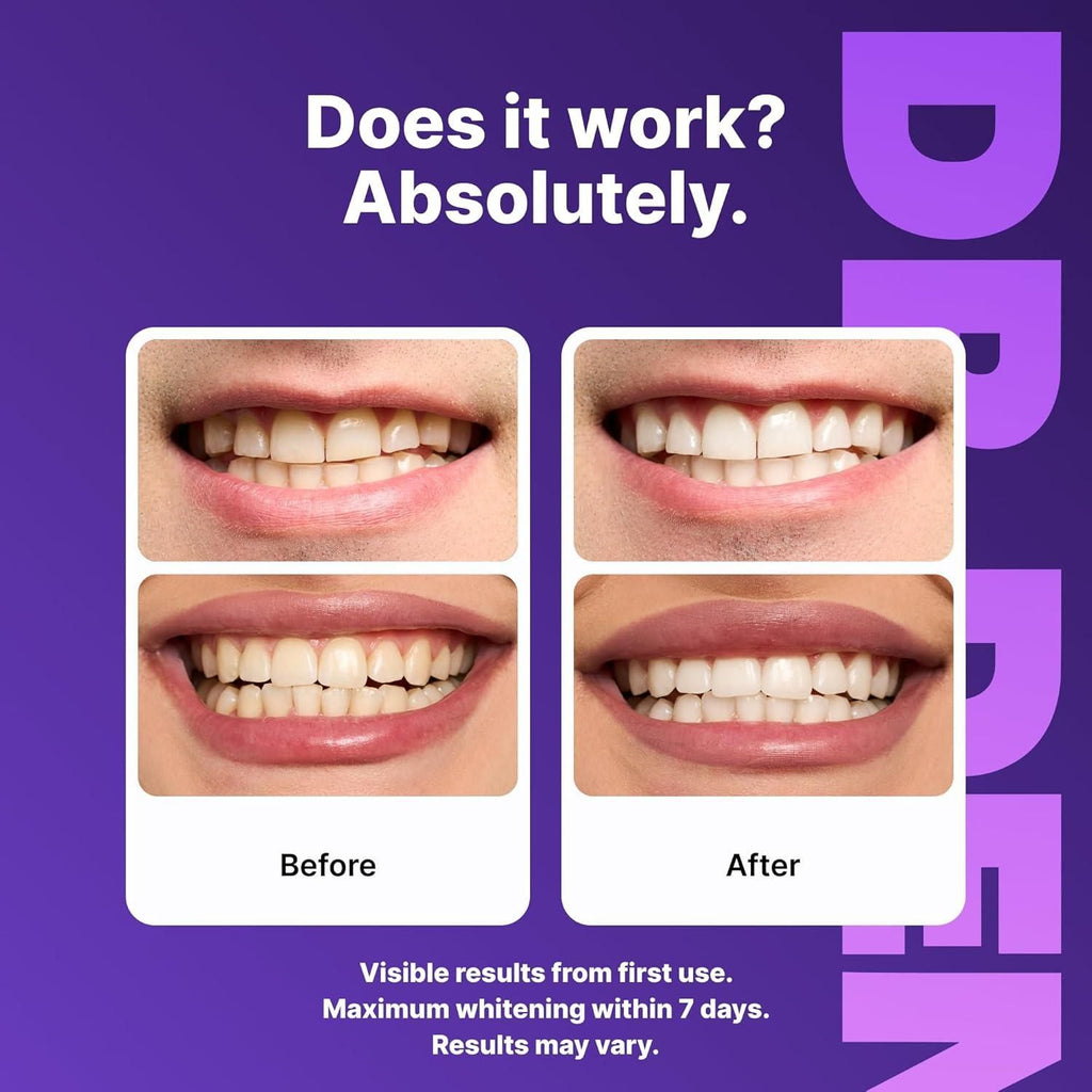 Purple Teeth Whitening Strips 42 Strips (Pack of 1)