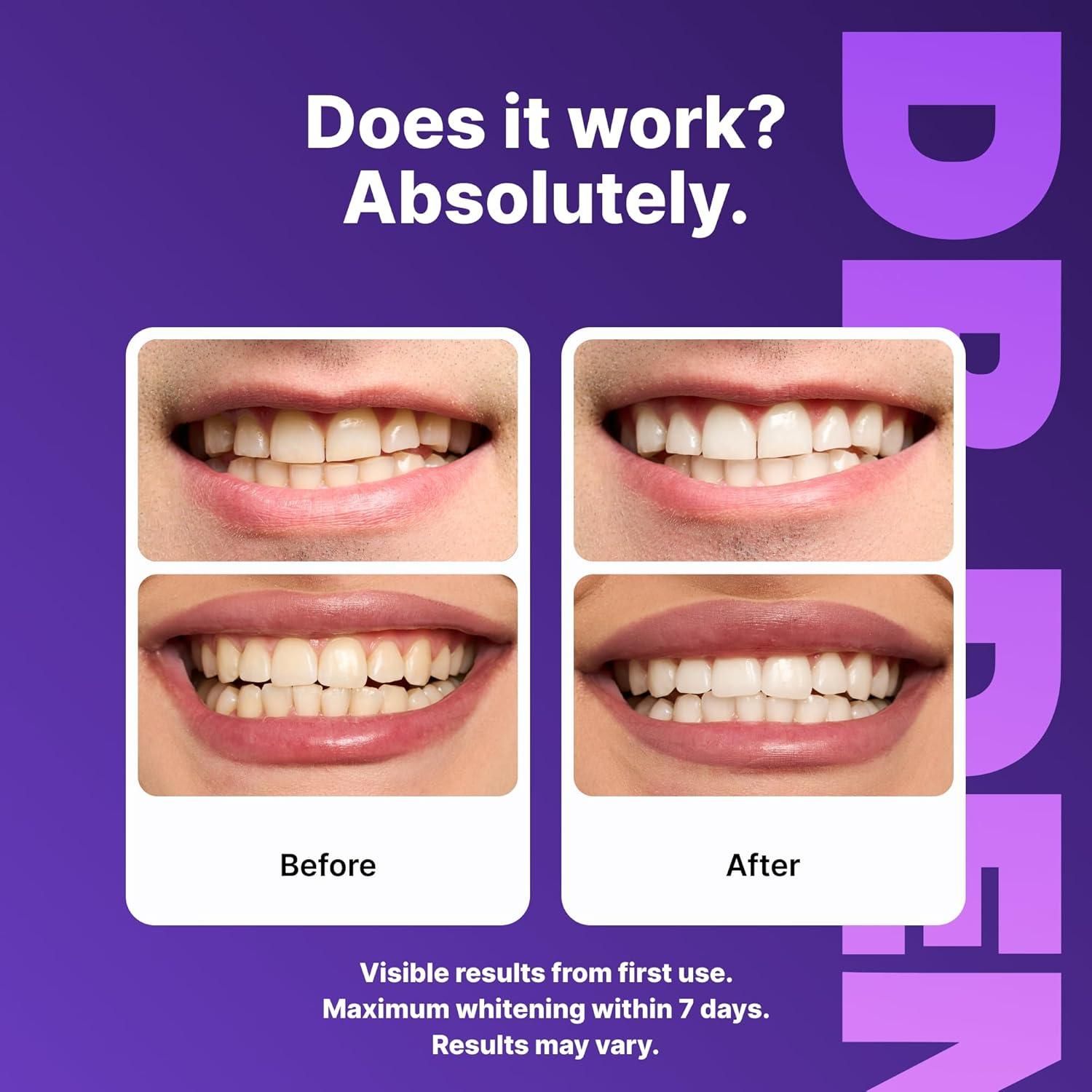 Purple Teeth Whitening Strips 42 Strips (Pack of 1)